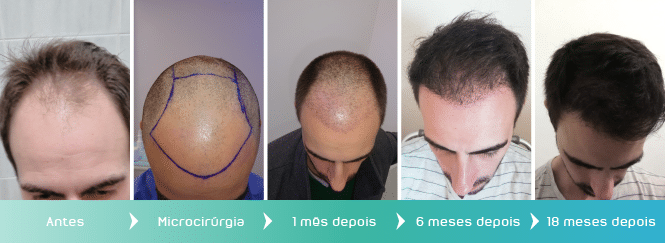 Evolução Marcio Passos Evolução Marcio Passos