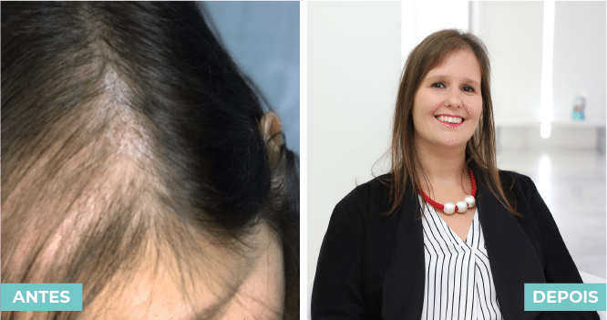 antes e depois samantha raimundo